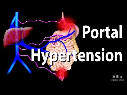 Understanding Portal Hypertension: Key Insights and Facts