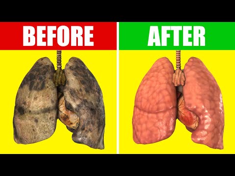 Lung Detox: Is Cleansing Your Lungs Really Possible? post thumbnail image