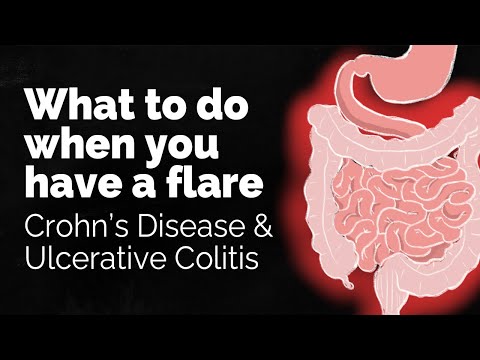 Sleeping Positions That Ease Crohn's Disease Discomfort