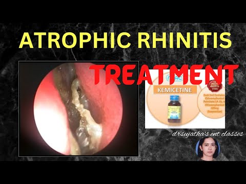Understanding Atrophic Rhinitis: Causes, Treatments, and Surgery