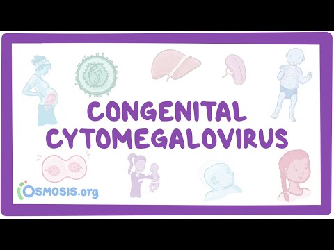 Understanding Cytomegalovirus: Symptoms, Causes, and Care