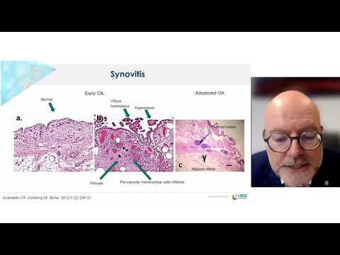 Understanding the Synovium: Key Functions and Health Insights post thumbnail image