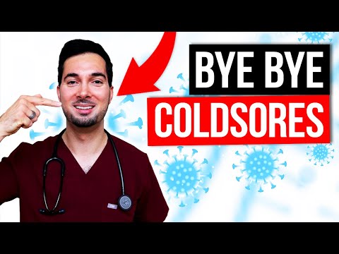 Banish Cold Sores for Good with These Simple Steps