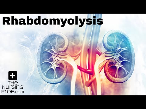 Understanding Rhabdomyolysis: Causes and Effective Treatments