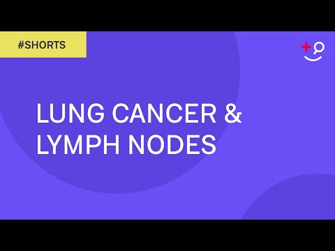 Understanding Cancer Spread to Lymph Nodes: Key Insights