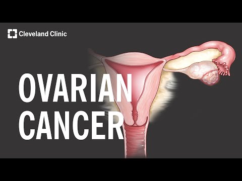 Understanding Ovary Pain: 7 Causes, Symptoms, and Treatments