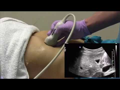 Understanding Abdominal Ultrasound: Benefits and Safety