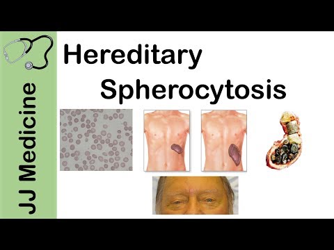 Understanding Hereditary Spherocytosis: Causes and Diagnosis
