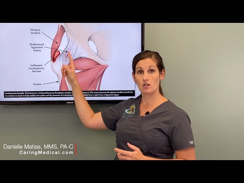 Understanding Iliopsoas Bursitis: Symptoms and Care Options post thumbnail image