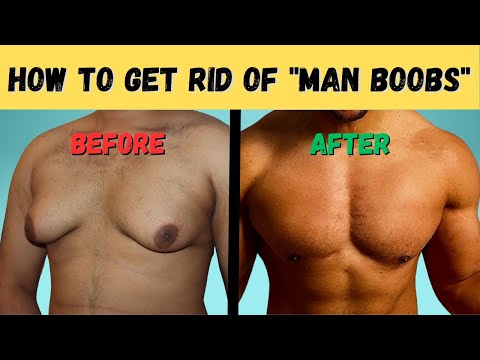 Top Exercises to Combat Gynecomastia Effectively