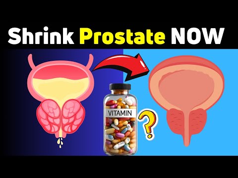 Top 7 Supplements for Optimal Prostate Health Solutions