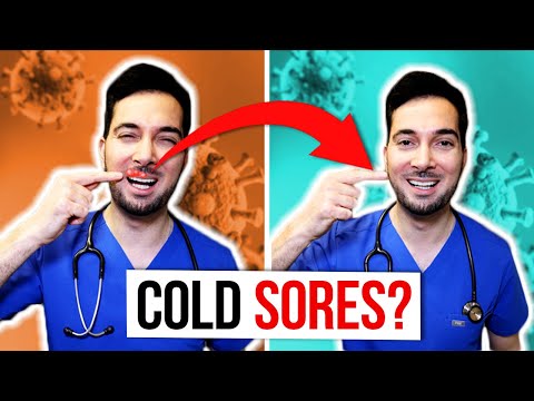 Speedy Solutions to Banish Cold Sores Fast