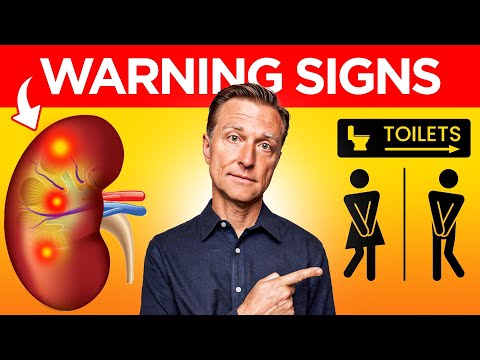 Recognizing 8 Key Signs of Kidney Stones