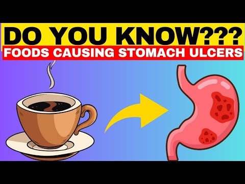 Key Foods to Avoid for Managing Your Peptic Ulcer Symptoms