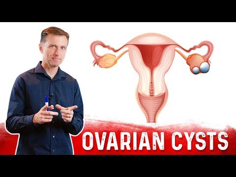 11 Effective Home Remedies for Ovarian Cyst Discomfort