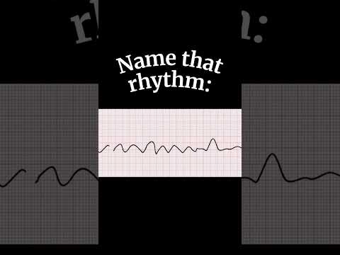 Understanding Arrhythmia: Is It a Life-Threatening Condition?
