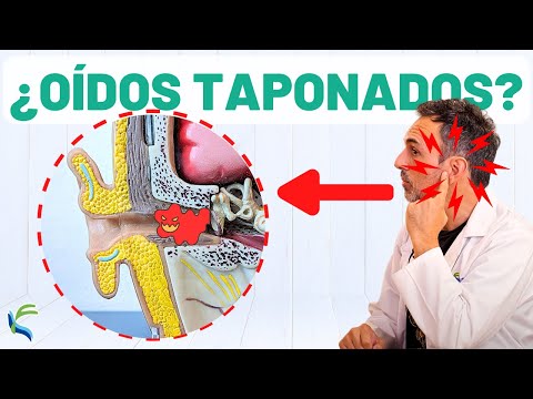 12 formas efectivas de eliminar el agua de los oídos post thumbnail image