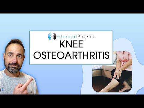 Understanding Knee Osteoarthritis: Symptoms and Treatments Explained post thumbnail image