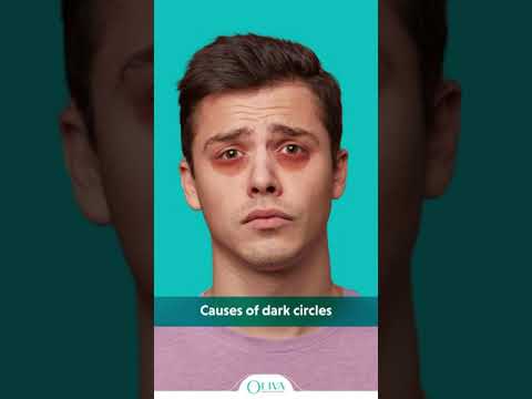 Understanding Dark Circles Under Your Child’s Eyes: Causes and Care post thumbnail image