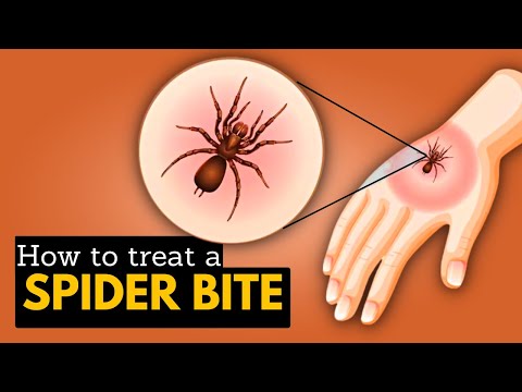 Insect Stings and Spider Bites: What You Should Know post thumbnail image
