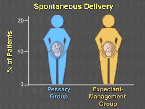 Cervical Cerclage: A Key to Preventing Premature Births post thumbnail image