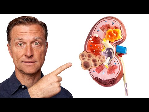 Nourishing Foods for a Healthy Kidney Disease Diet post thumbnail image