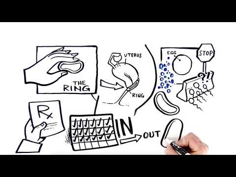 Understanding the Vaginal Ring for Effective Birth Control