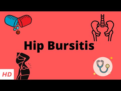Understanding Outer Hip Pain: Causes and Treatment Options
