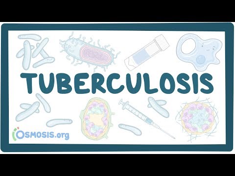 Understanding TB Tests: Your Path to Better Health