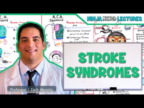 Understanding Causes and Symptoms of Middle Cerebral Artery Stroke