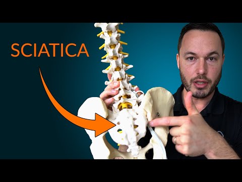 Understanding Sciatic Nerve Pain: Causes and Treatments