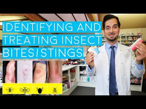 Understanding Blister Beetle Bites: Symptoms and Care