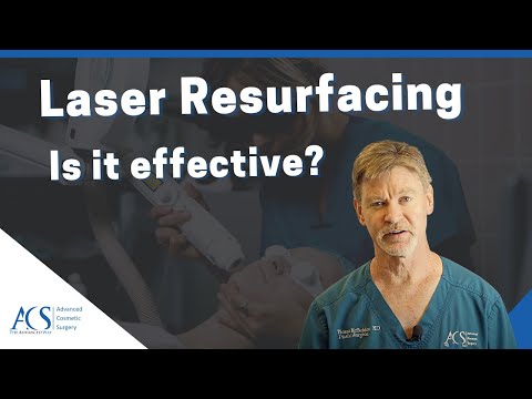Key Insights on Laser Skin Resurfacing for Healthy Skin