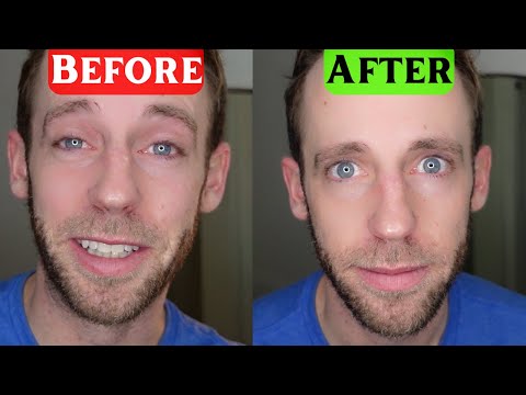 Understanding Clear Eyes Redness Relief Drops: Uses and Risks
