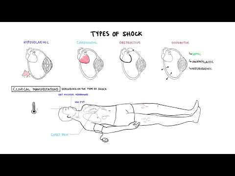 Understanding Hypovolemic Shock: Causes and Symptoms Explained