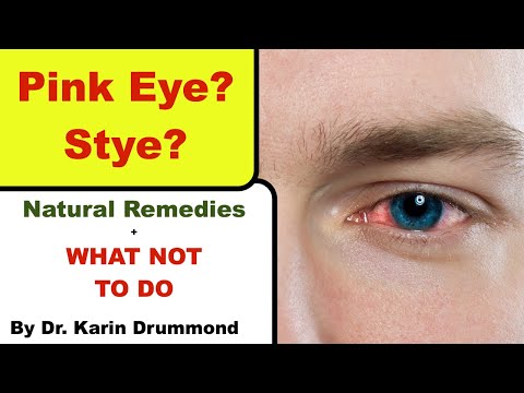 Home Remedies for Pink Eye: What Works?