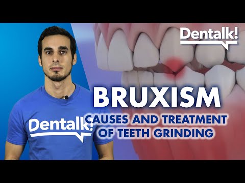 Understanding Teeth Grinding: Causes, Symptoms, and Solutions