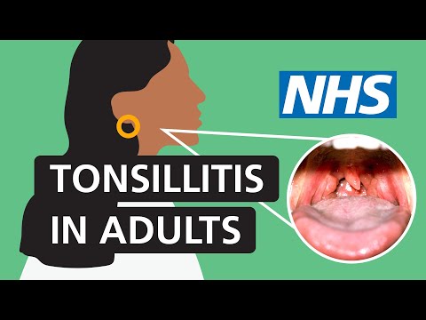Understanding Health Risks Linked to Swollen Tonsils post thumbnail image