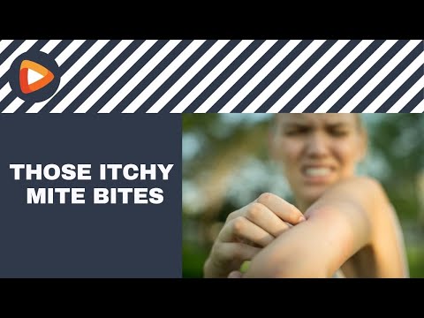 Mite Bites: Signs You Might Be Experiencing Them