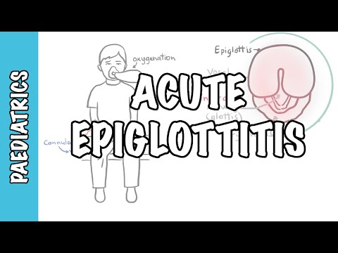Understanding Epiglottitis: Symptoms and Diagnosis Explained