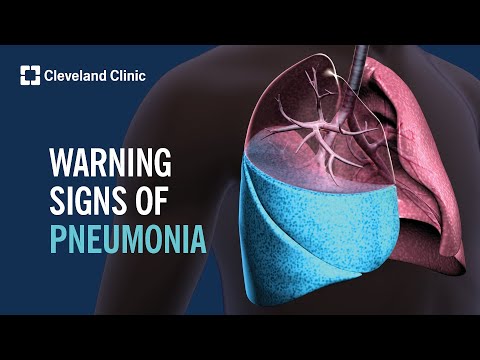 Coughing Concerns: Signs You Should Seek Medical Help