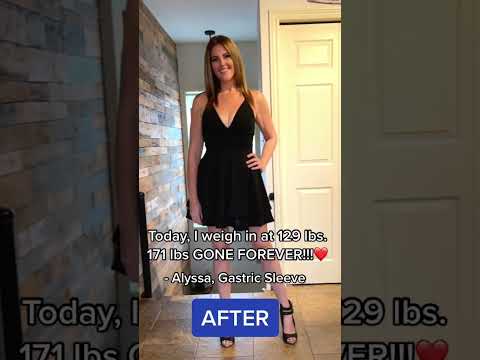 What Happens After Weight Loss Surgery? Your Journey Ahead post thumbnail image