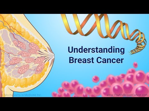 Understanding Breast Cancer Causes and Risk Factors for Prevention