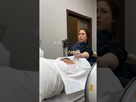 Find Relief: Radiofrequency Ablation for Arthritis Pain