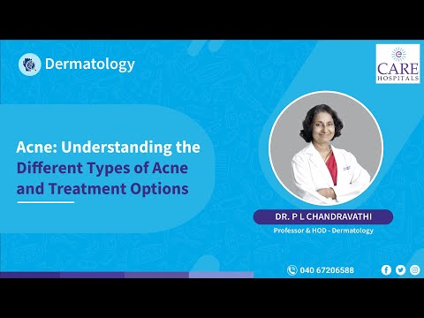 Types of Acne: Visuals and Effective Treatment Options