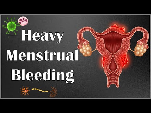 Understanding Menorrhagia: Causes, Symptoms, and Help