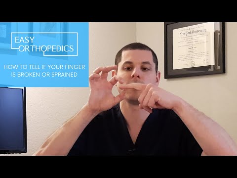 Is Your Finger Broken? Key Signs and What to Do Next