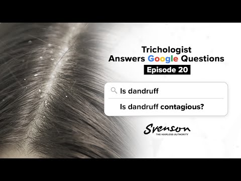 Is Dandruff Contagious? Answers to Your Flaky Questions