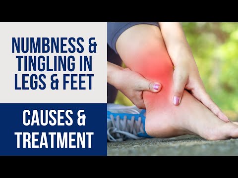 Understanding Numbness: Symptoms, Causes, and Care Options