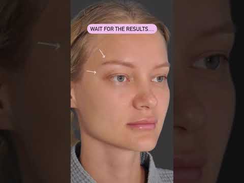 Revitalize Your Look with a Stunning Brow Lift